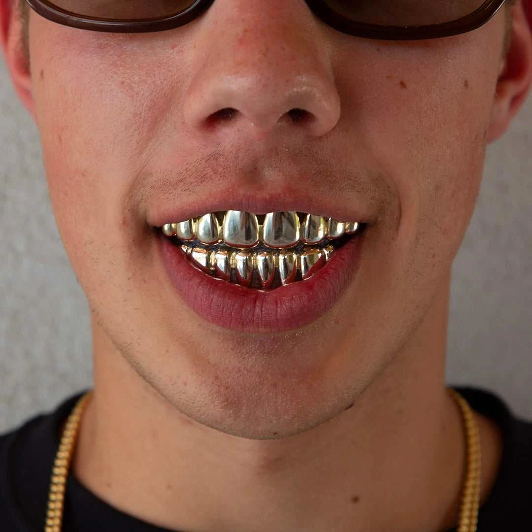 Golden Dripping Grillz In Yellow Gold 6 Golden Dripping Grillz In Yellow Gold - Image 6